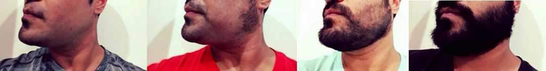 Spartan Balsamo Colombia Crecimiento de Barba Minoxidil